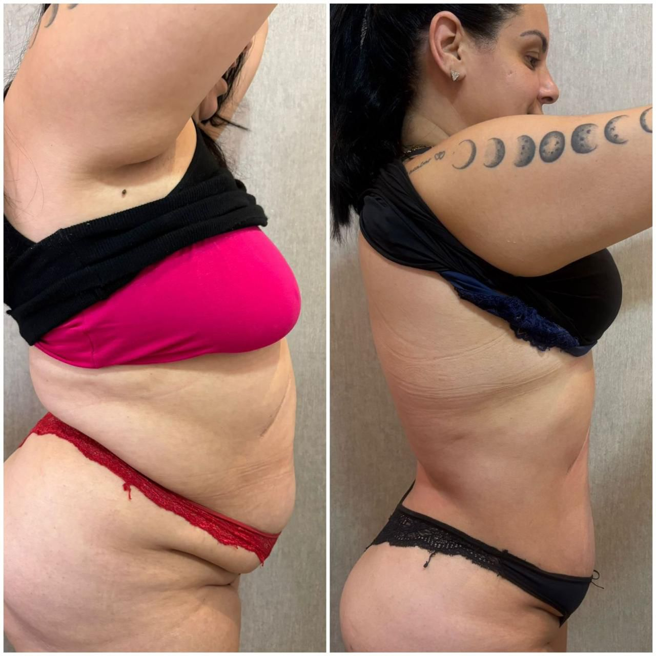 Cecília, antes e depois